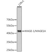 Western blot analysis of lysates from 22Rv1 cells, using MAGE-1/MAGE1A Antibody at 1/1000 dilution. Secondary antibody: HRP-conjugated Goat anti-Rabbit IgG (H+L) at 1/10000 dilution. Lysates/proteins: 25 µg per lane. Blocking buffer: 3% nonfat dry milk in TBST. Exposure time: 30s.