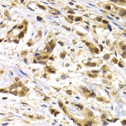 Melanoma-Associated Antigen 1 (MAGEA1) Antibody