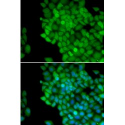 Melanoma-Associated Antigen 1 (MAGEA1) Antibody