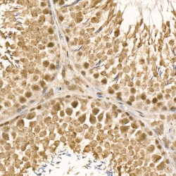 Ubiquitin Conjugating Enzyme E2C (UBE2C) Antibody