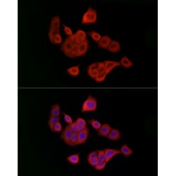 Ubiquitin Conjugating Enzyme E2C (UBE2C) Antibody