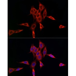 Ubiquitin Conjugating Enzyme E2C (UBE2C) Antibody