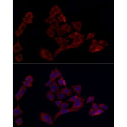 Ubiquitin Conjugating Enzyme E2C (UBE2C) Antibody