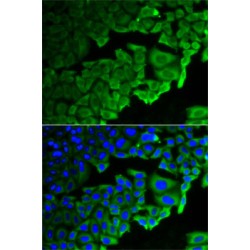 Ribosomal Protein Lateral Stalk Subunit P0 (RPLP0) Antibody