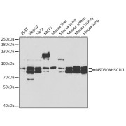 Western blot analysis of various lysates using [KO Validated] NSD3/WHSC1L1 Antibody at 1/1000 dilution. Secondary antibody: HRP-conjugated Goat anti-Rabbit IgG (H+L) at 1/10000 dilution. Lysates/proteins: 25 µg per lane. Blocking buffer: 3% nonfat dry milk in TBST. Exposure time: 90s.