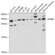 Western blot analysis of various lysates using RAB6A Antibody at 1/1000 dilution. Secondary antibody: HRP-conjugated Goat anti-Rabbit IgG (H+L) at 1/10000 dilution. Lysates/proteins: 25 µg per lane. Blocking buffer: 3% nonfat dry milk in TBST. Exposure time: 30s.