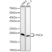 Western blot analysis of various lysates, using PSCA Antibody at 1/3000 dilution. Secondary antibody: HRP-conjugated Goat anti-Rabbit IgG (H+L) at 1/10000 dilution. Lysates/proteins: 25 µg per lane. Blocking buffer: 3% nonfat dry milk in TBST. Exposure time: 180s.