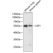 Western blot analysis of various lysates using LSP1 Antibody at 1/1000 dilution. Secondary antibody: HRP-conjugated Goat anti-Rabbit IgG (H+L) at 1/10000 dilution. Lysates/proteins: 25 µg per lane. Blocking buffer: 3% nonfat dry milk in TBST. Exposure time: 30s.