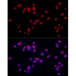 cAMP Responsive Element Modulator (CREM) Antibody