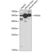 Western blot analysis of various lysates using HTR3A Antibody at 1/1000 dilution. Secondary antibody: HRP-conjugated Goat anti-Rabbit IgG (H+L) at 1/10000 dilution. Lysates/proteins: 25 µg per lane. Blocking buffer: 3% nonfat dry milk in TBST. Exposure time: 30s.