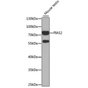 Western blot analysis of lysates from mouse testis, using PIAS2 Antibody at 1/1000 dilution. Secondary antibody: HRP-conjugated Goat anti-Rabbit IgG (H+L) at 1/10000 dilution. Lysates/proteins: 25 µg per lane. Blocking buffer: 3% nonfat dry milk in TBST. Exposure time: 60s.