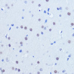 Protein Inhibitor of Activated STAT2 (PIAS2) Antibody