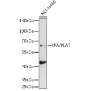 Western blot analysis of lysates from NCI-H460 cells, using tPA/PLAT Antibody at 1/1000 dilution. Secondary antibody: HRP-conjugated Goat anti-Rabbit IgG (H+L) at 1/10000 dilution. Lysates/proteins: 25 µg per lane. Blocking buffer: 3% nonfat dry milk in TBST. Exposure time: 30s.