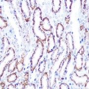 Western blot analysis of lysates from HCT116 cells, using Smad4 Antibody at 1/600 dilution. Secondary antibody: HRP-conjugated Goat anti-Rabbit IgG (H+L) at 1/10000 dilution. Lysates/proteins: 25 µg per lane. Blocking buffer: 3% nonfat dry milk in TBST. Exposure time: 30s.