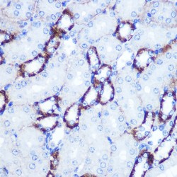 Mothers Against Decapentaplegic Homolog 4 (SMAD4) Antibody