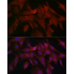 Mothers Against Decapentaplegic Homolog 4 (SMAD4) Antibody