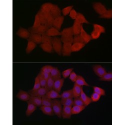 Mothers Against Decapentaplegic Homolog 4 (SMAD4) Antibody