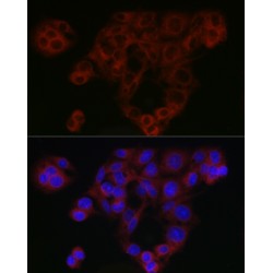 Mothers Against Decapentaplegic Homolog 4 (SMAD4) Antibody