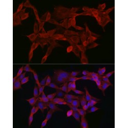 Mothers Against Decapentaplegic Homolog 4 (SMAD4) Antibody