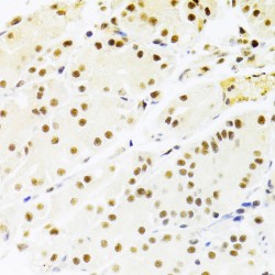 Recombining Binding Protein Suppressor Of Hairless (RBPJ) Antibody