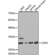 Western blot analysis of various lysates using [KO Validated] CDK5 Antibody at 1/1000 dilution. Secondary antibody: HRP-conjugated Goat anti-Rabbit IgG (H+L) at 1/10000 dilution. Lysates/proteins: 25 µg per lane. Blocking buffer: 3% nonfat dry milk in TBST. Exposure time: 30s.