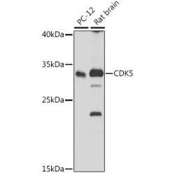 Cyclin-Dependent-Like Kinase 5 (CDK5) Antibody