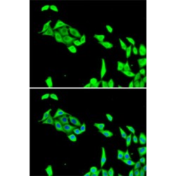 Cyclin-Dependent-Like Kinase 5 (CDK5) Antibody