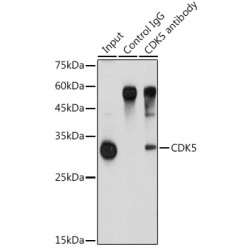 Cyclin-Dependent-Like Kinase 5 (CDK5) Antibody