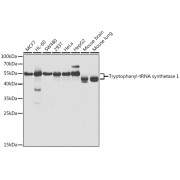 Western blot analysis of various lysates using Tryptophanyl-tRNA synthetase 1 Antibody at 1/1000 dilution. Secondary antibody: HRP-conjugated Goat anti-Rabbit IgG (H+L) at 1/10000 dilution. Lysates/proteins: 25 µg per lane. Blocking buffer: 3% nonfat dry milk in TBST. Exposure time: 5s.