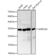 Western blot analysis of various lysates, using ANP32A Antibody at 1/2000 dilution. Secondary antibody: HRP-conjugated Goat anti-Rabbit IgG (H+L) at 1/10000 dilution. Lysates/proteins: 25 µg per lane. Blocking buffer: 3% nonfat dry milk in TBST. Exposure time: 10s.