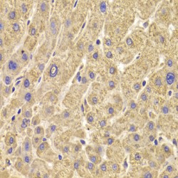 Peroxisomal Biogenesis Factor 5 (PEX5) Antibody