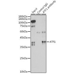 Cyclic AMP-Dependent Transcription Factor ATF-1 (ATF1) Antibody