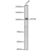 Western blot analysis of lysates from Jurkat cells, using SATB1 Antibody at 1/1000 dilution. Secondary antibody: HRP-conjugated Goat anti-Rabbit IgG (H+L) at 1/10000 dilution. Lysates/proteins: 25 µg per lane. Blocking buffer: 3% nonfat dry milk in TBST. Exposure time: 1s.