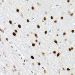 SATB Homeobox 1 (SATB1) Antibody