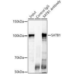 SATB Homeobox 1 (SATB1) Antibody