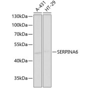 Western blot analysis of various lysates using SERPINA6 Antibody at 1/1000 dilution. Secondary antibody: HRP-conjugated Goat anti-Rabbit IgG (H+L) at 1/10000 dilution. Lysates/proteins: 25 µg per lane. Blocking buffer: 3% nonfat dry milk in TBST. Exposure time: 90s.