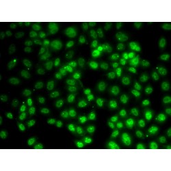 Protein Arginine N-Methyltransferase 2 (PRMT2) Antibody