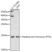 Western blot analysis of various lysates using Parathyroid Hormone (PTH) Antibody at 1/1000 dilution. Secondary antibody: HRP-conjugated Goat anti-Rabbit IgG (H+L) at 1/10000 dilution. Lysates/proteins: 25 µg per lane. Blocking buffer: 3% nonfat dry milk in TBST. Exposure time: 60s.