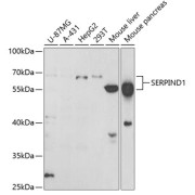 Western blot analysis of various lysates using SERPIND1 Antibody at 1/1000 dilution. Secondary antibody: HRP-conjugated Goat anti-Rabbit IgG (H+L) at 1/10000 dilution. Lysates/proteins: 25 µg per lane. Blocking buffer: 3% nonfat dry milk in TBST. Exposure time: 90s.