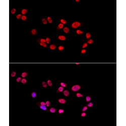 X-Ray Repair Cross Complementing 5 (XRCC5) Antibody