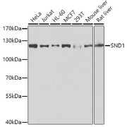 Western blot analysis of various lysates using [KO Validated] SND1 Antibody at 1/1000 dilution. Secondary antibody: HRP-conjugated Goat anti-Rabbit IgG (H+L) at 1/10000 dilution. Lysates/proteins: 25 µg per lane. Blocking buffer: 3% nonfat dry milk in TBST. Exposure time: 1s.