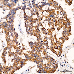 Staphylococcal Nuclease Domain-Containing Protein 1 (SND1) Antibody