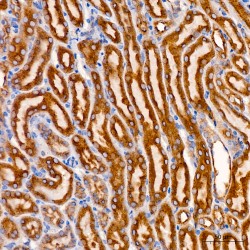 Staphylococcal Nuclease Domain-Containing Protein 1 (SND1) Antibody