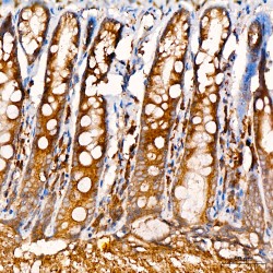 Staphylococcal Nuclease Domain-Containing Protein 1 (SND1) Antibody