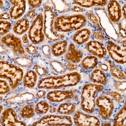 Staphylococcal Nuclease Domain-Containing Protein 1 (SND1) Antibody