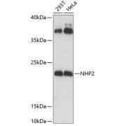 Western blot analysis of various lysates using NHP2 Antibody at 1/3000 dilution. Secondary antibody: HRP-conjugated Goat anti-Rabbit IgG (H+L) at 1/10000 dilution. Lysates/proteins: 25 µg per lane. Blocking buffer: 3% nonfat dry milk in TBST. Exposure time: 60s.