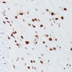 28S rRNA (Cytosine-C(5))-Methyltransferase (NSUN5) Antibody