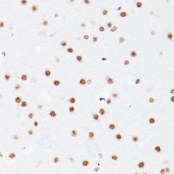 28S rRNA (Cytosine-C(5))-Methyltransferase (NSUN5) Antibody