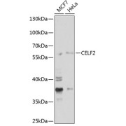 Western blot analysis of various lysates using CELF2 Antibody at 1/1000 dilution. Secondary antibody: HRP-conjugated Goat anti-Rabbit IgG (H+L) at 1/10000 dilution. Lysates/proteins: 25 µg per lane. Blocking buffer: 3% nonfat dry milk in TBST. Exposure time: 180s.