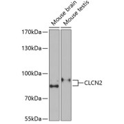 Western blot analysis of various lysates using CLCN2 Antibody at 1/1000 dilution. Secondary antibody: HRP-conjugated Goat anti-Rabbit IgG (H+L) at 1/10000 dilution. Lysates/proteins: 25 µg per lane. Blocking buffer: 3% nonfat dry milk in TBST. Exposure time: 90s.